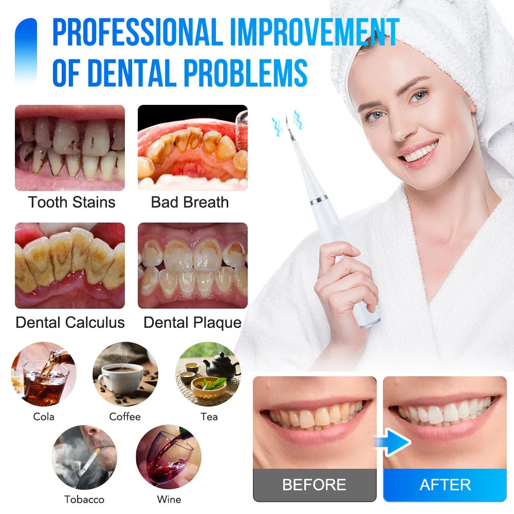 High Power Ultrasonic Dental Cleaner Electric Sonic Device for Tartar Plaque and Teeth Stain Removal
